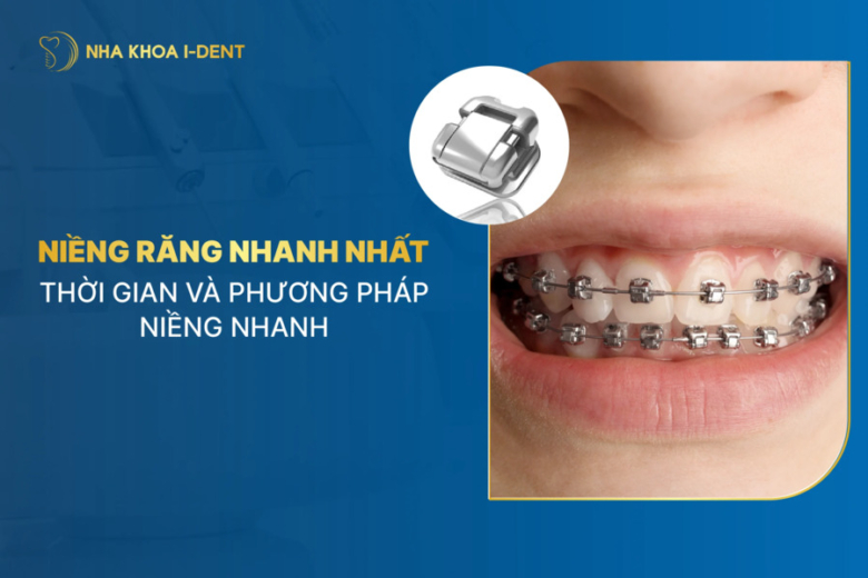Niềng răng nhanh đem lại hiệu quả tại Nha khoa I-Dent