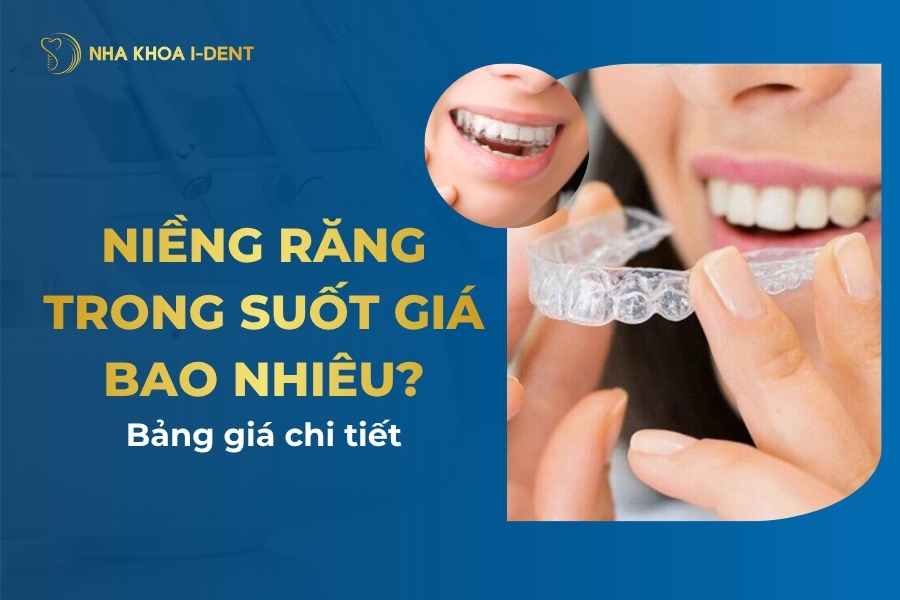 Niềng răng trong suốt giá bao nhiêu? Giá niềng [04/2026]