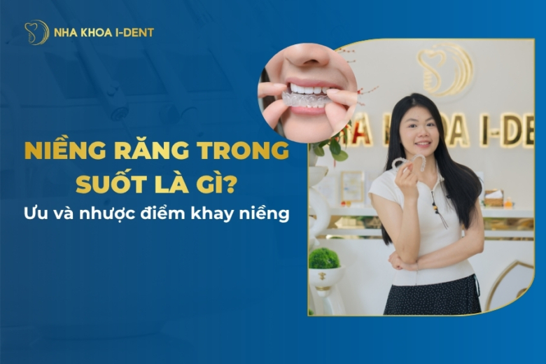 Niềng răng trong suốt là gì? Ưu và nhược điểm khay niềng? Giá