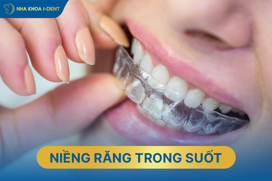 nên niềng răng trong suốt hay mắc cài