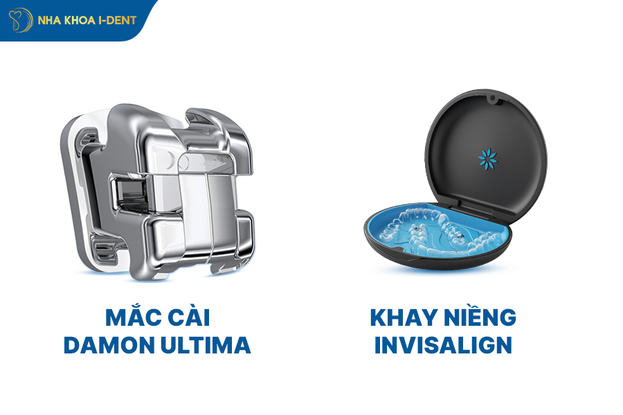 phương pháp niềng răng nhanh
