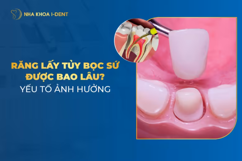 răng lấy tủy bọc sứ được bao lâu