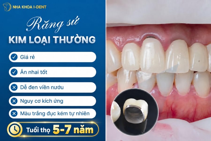 răng sứ bao lâu phải thay