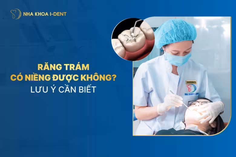 Răng Trám Có Niềng Được Không? Lưu Ý Cần Biết