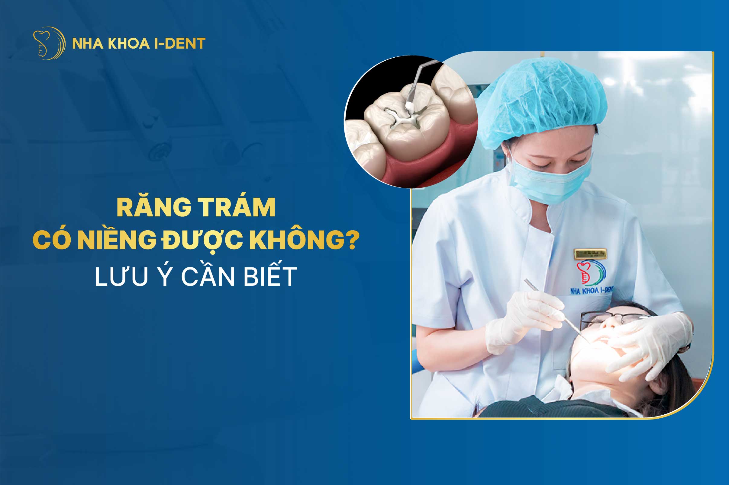 Trám Răng Có Niềng Được Không? Lưu Ý Cần Biết