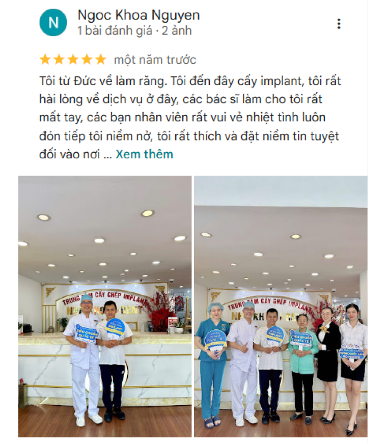review trồng răng implant