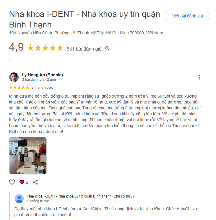 review trồng răng implant tại ident