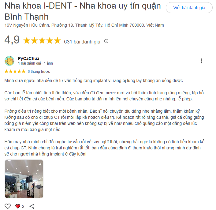 review trồng răng implant tại ident