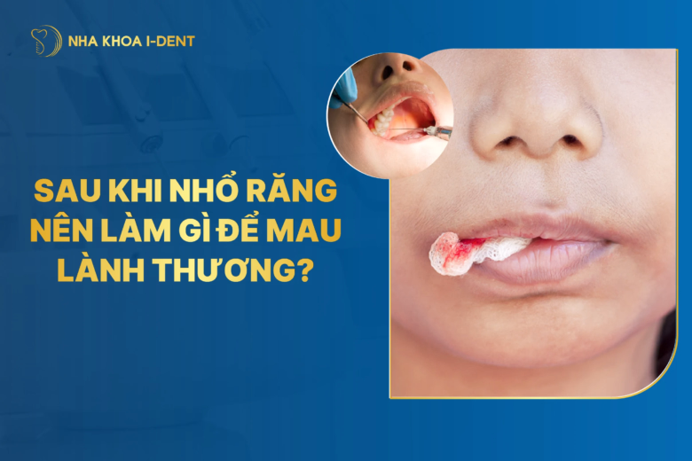 sau khi nhổ răng