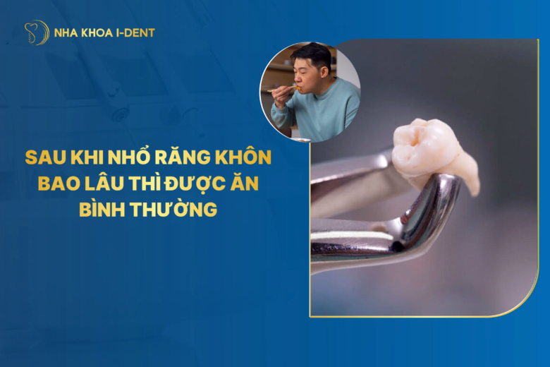 sau khi nhổ răng khôn bao lâu thì được ăn