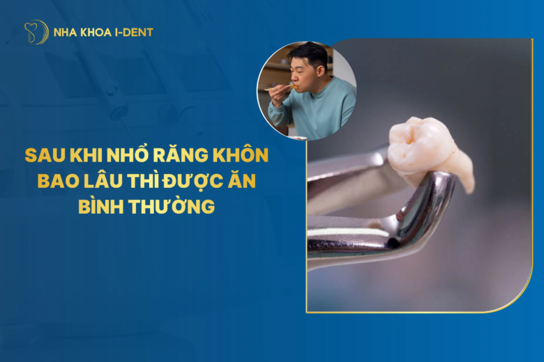 Sau khi nhổ răng khôn bao lâu thì được ăn bình thường