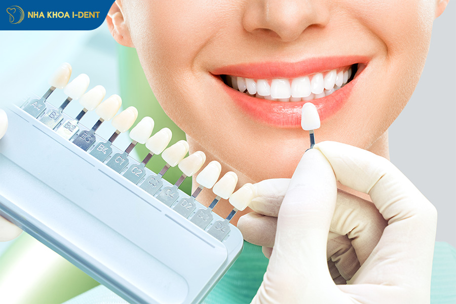 thẻ bảo hành răng sứ