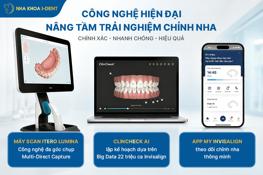 niềng răng bao nhiêu tiền