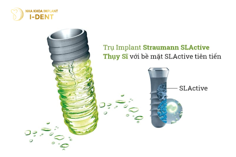 thời gian trồng implant