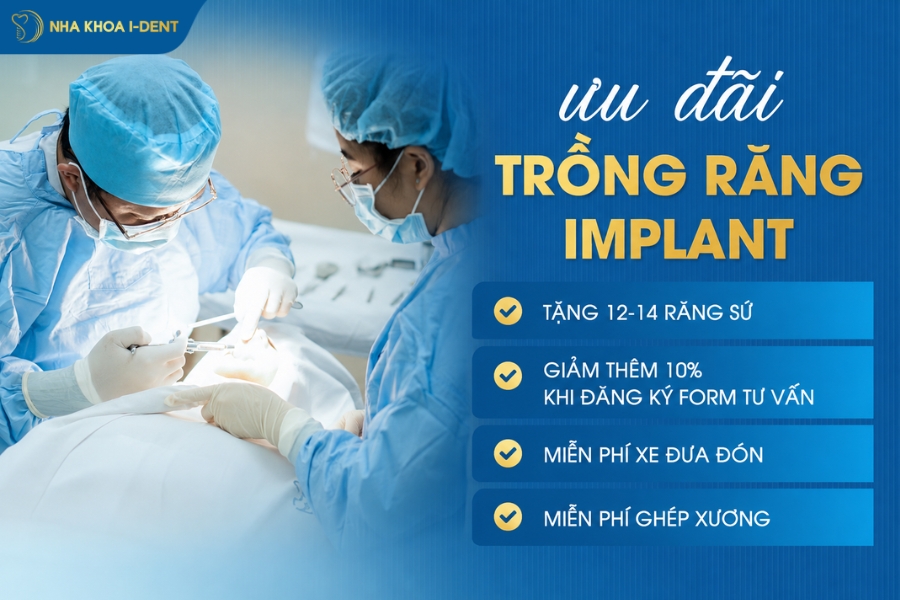 tuổi thọ răng implant - Nha khoa I-Dent