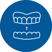 Nha khoa I-Dent tặng răng tạm cho khách hàng khi cấy implant.