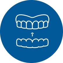Nha khoa I-Dent tặng răng tạm cho khách hàng khi cấy implant.