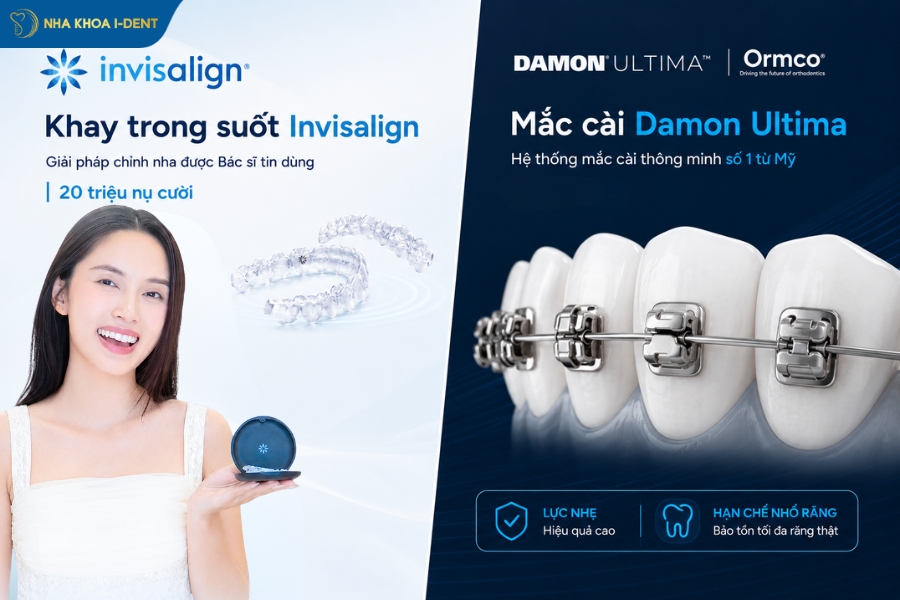 Vật liệu chỉnh nha tại Nha khoa I-Dent đều được nhập khẩu trực tiếp từ các thương hiệu lớn