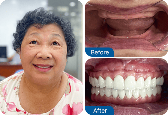Ms. Duong Vong Hung