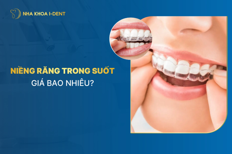 Niềng Răng Trong Suốt Giá Bao Nhiêu? Giá Niềng [T5/2026]