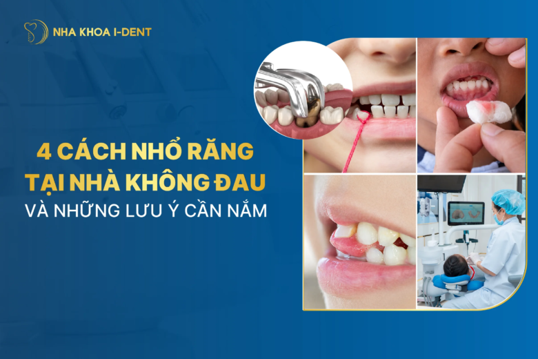 4 Cách nhổ răng tại nhà không đau và những lưu ý cần nắm
