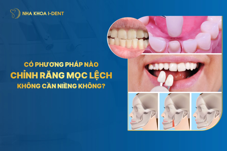 Có phương pháp nào chỉnh răng mọc lệch không cần niềng?