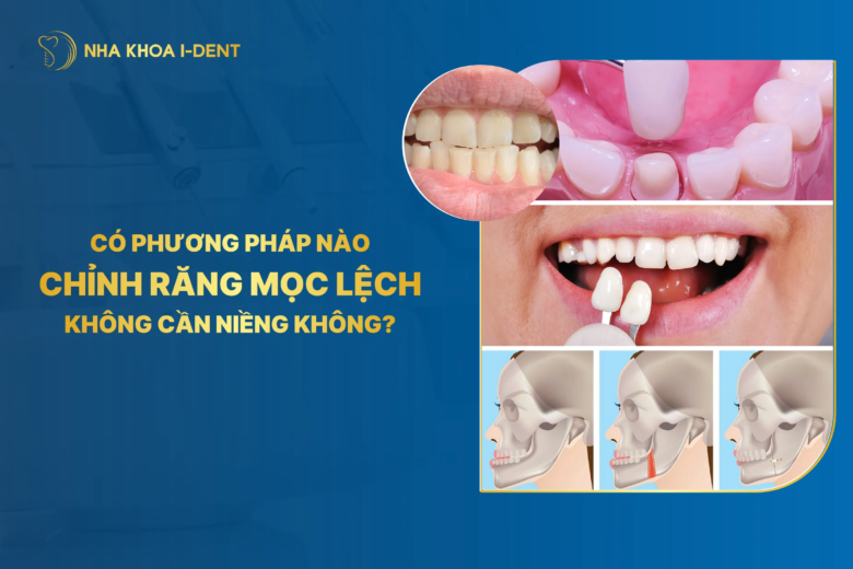 Có cách chỉnh răng mọc lệch không cần niềng không?
