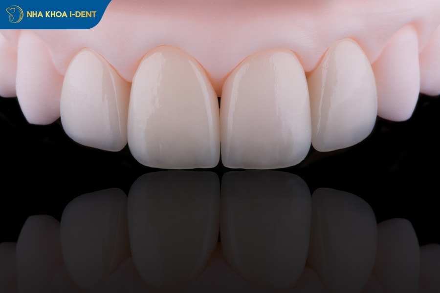 does insurance cover dental implants
