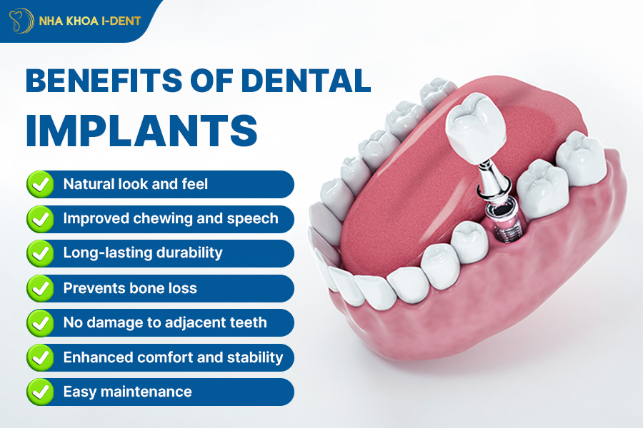 dental implant