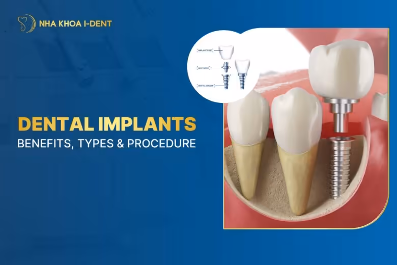 Dental Implants: Benefits, Types & Procedure