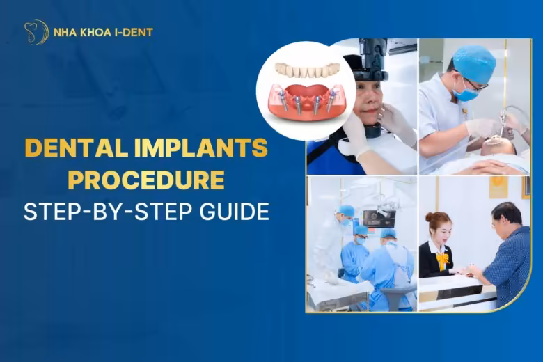 Dental Implants Procedure: Step-by-Step Guide