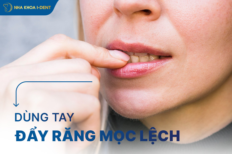 dùng tay đẩy răng mọc lệch