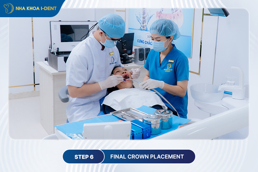 final crown placement