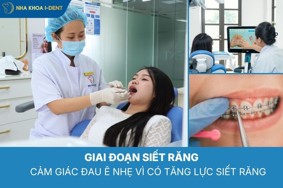 giai đoạn siết răng gây đau khi niềng