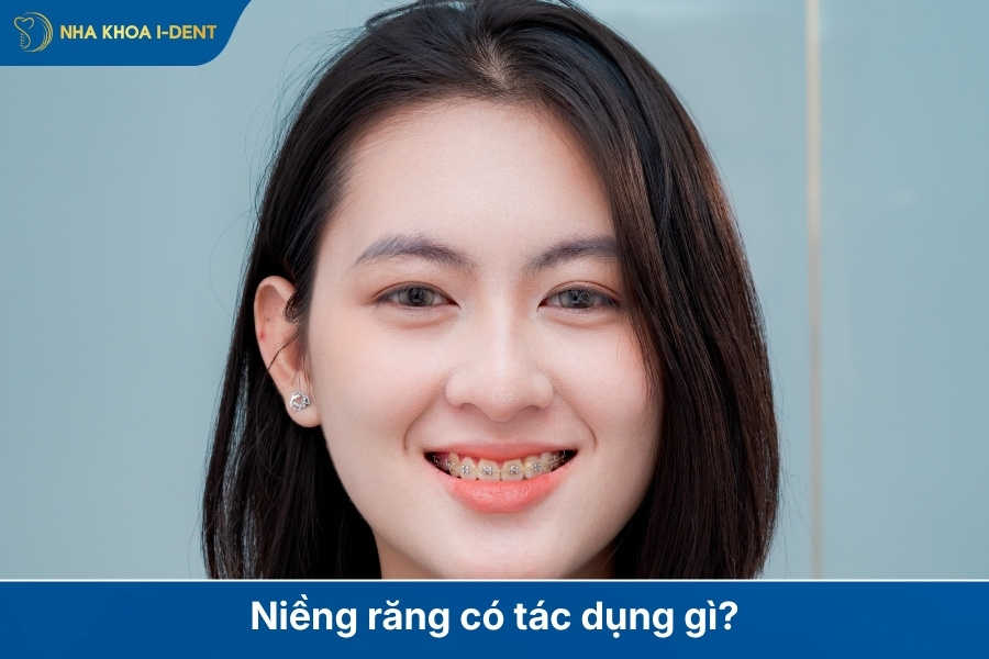 lợi ích khi niềng răng