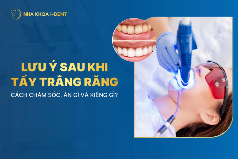 lưu ý sau khi tẩy trắng răng