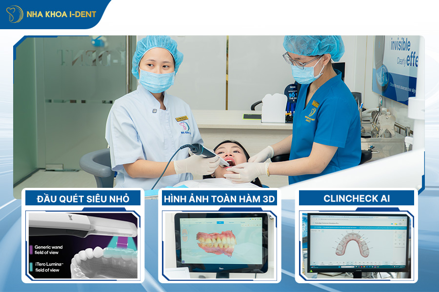 miếng niềng răng trong suốt
