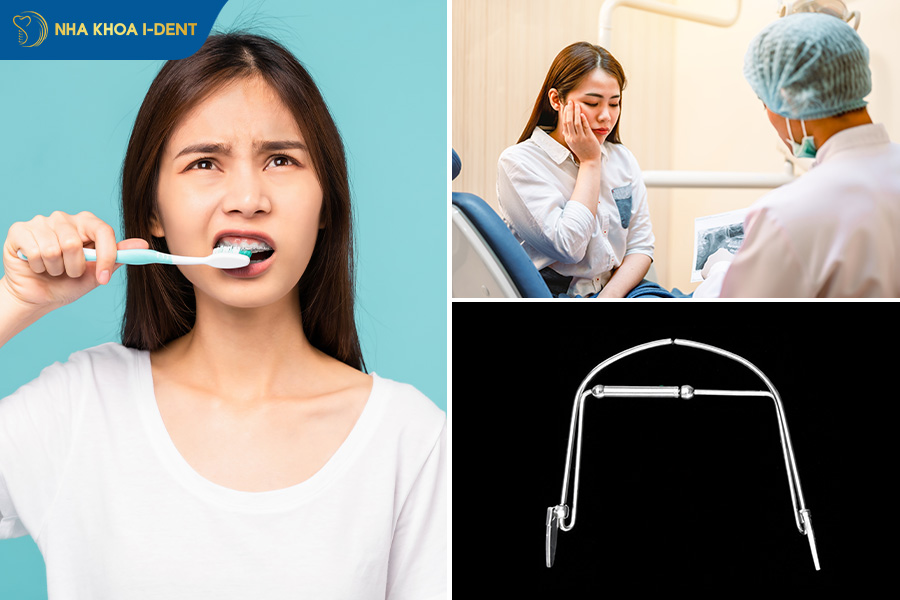 nguyên nhân niềng răng hỏng