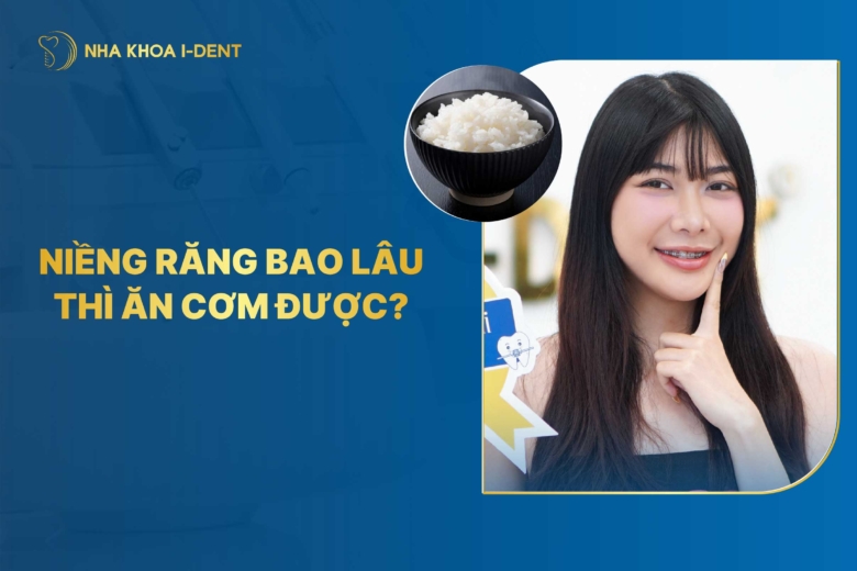 [Giải đáp] Niềng răng bao lâu thì ăn được cơm?
