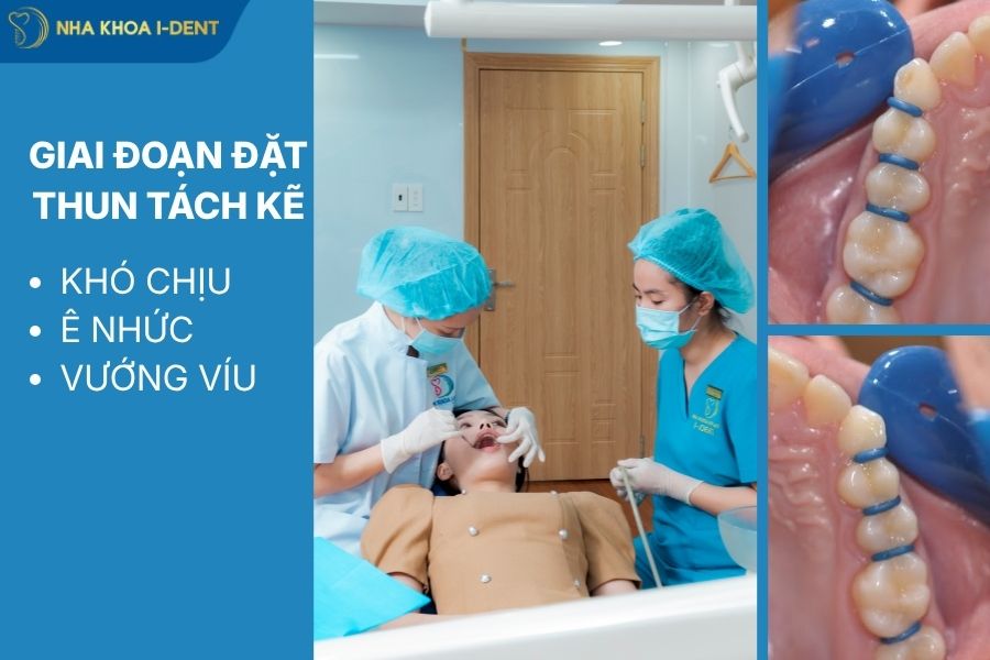 niềng răng có đau hay không