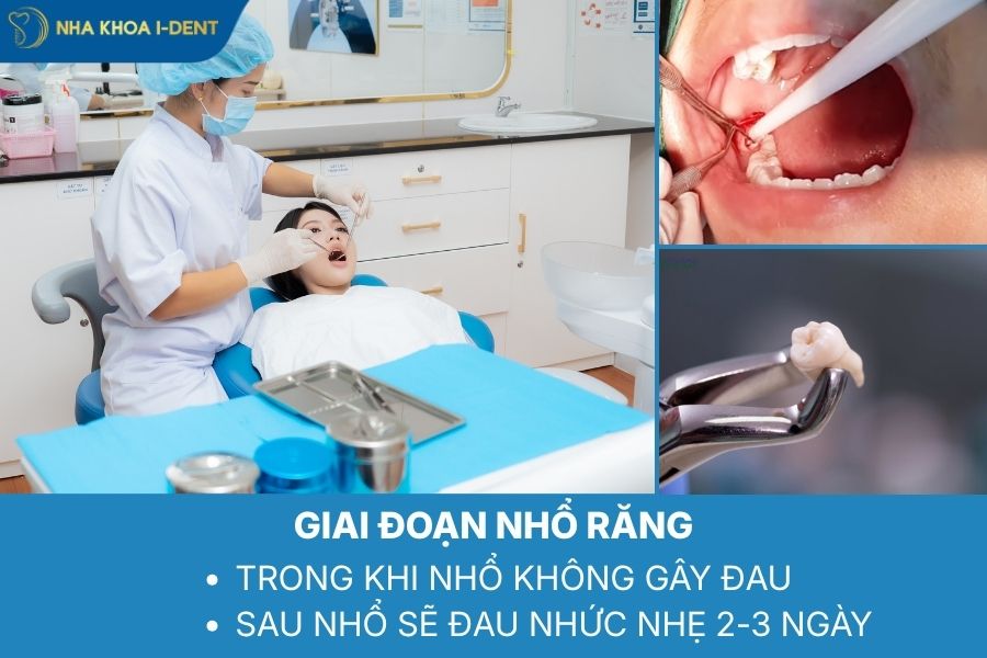 niềng răng đau khi nhổ răng