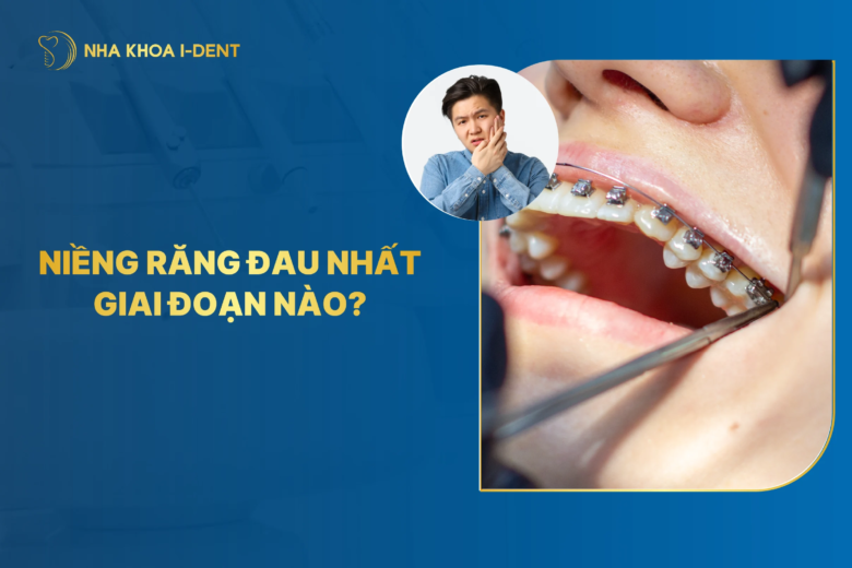 Giai Đoạn Nào Đau Nhất Khi Niềng Răng? Cách Giảm Đau