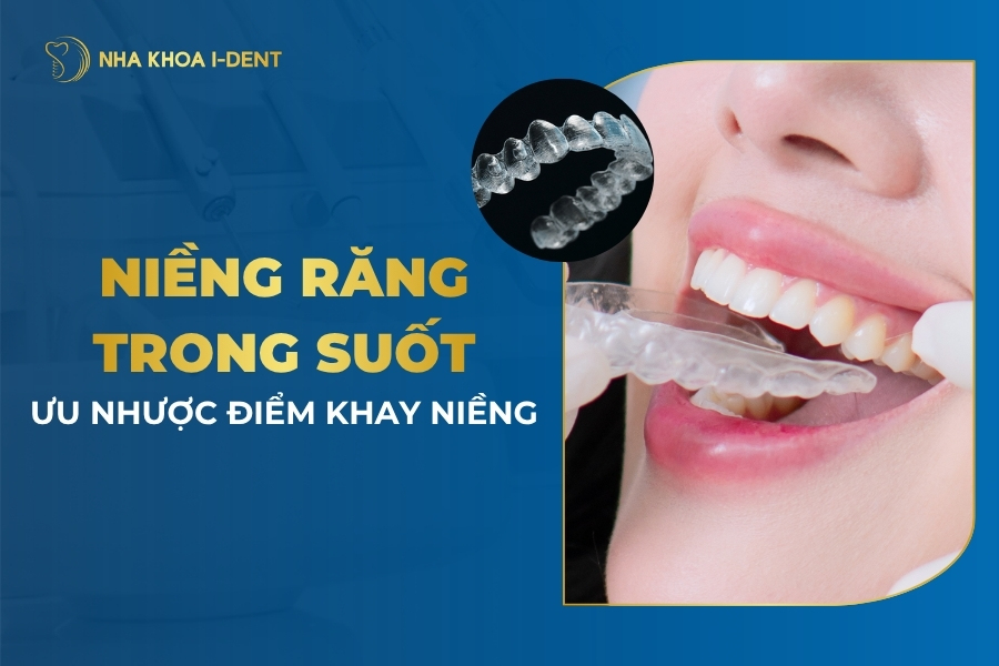 niềng răng trong suốt