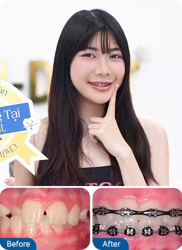 Common Cases For Orthodontics