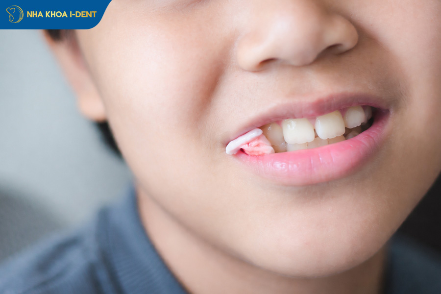 phương pháp giảm đau nhanh sau nhổ răng