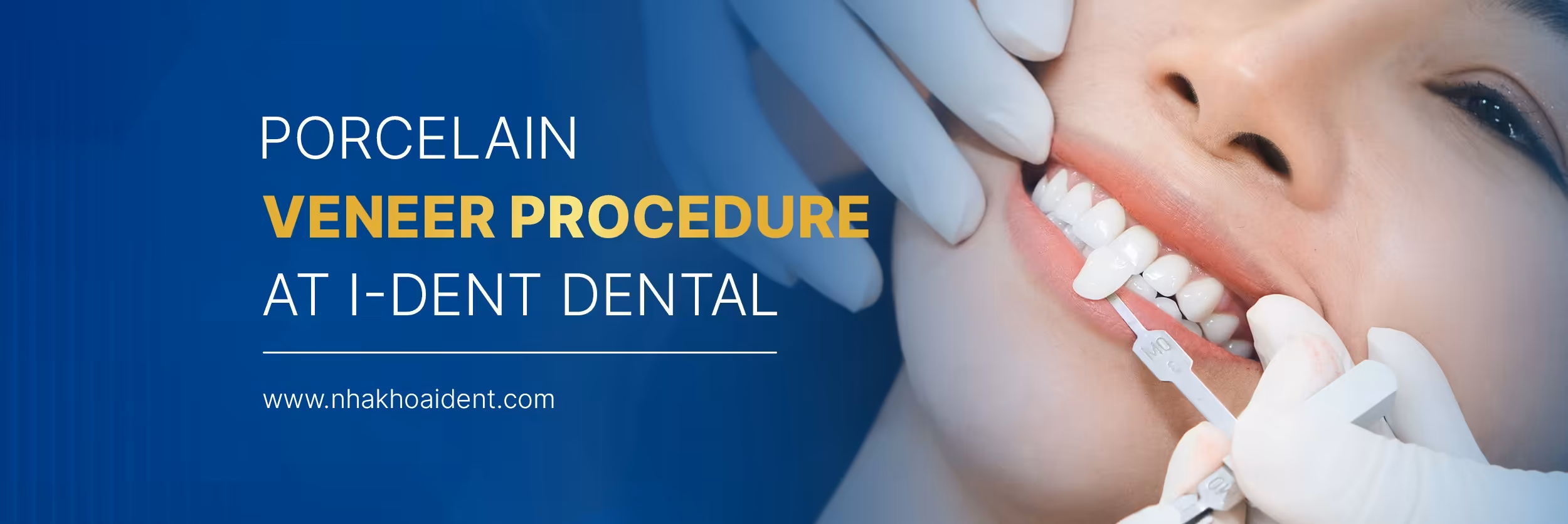 Porcelain Veneer Procedure