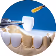porcelain veneers