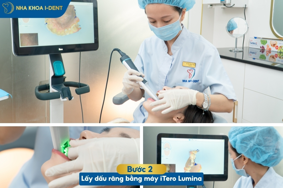 quy trình niềng invisalign