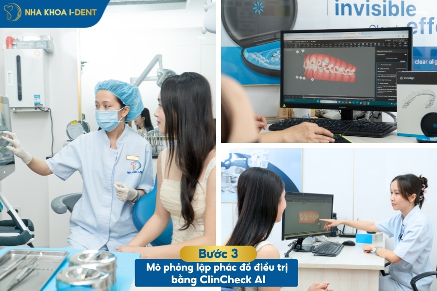 quy trình niềng khay invisalign