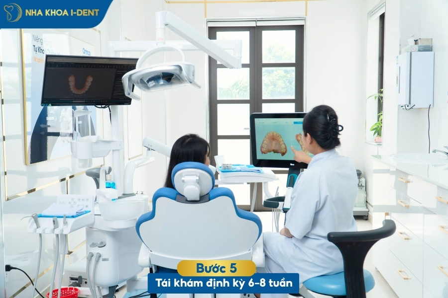quy trình niềng răng invisalign mấy bước